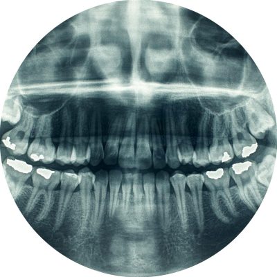dentist equipment panorama x ray